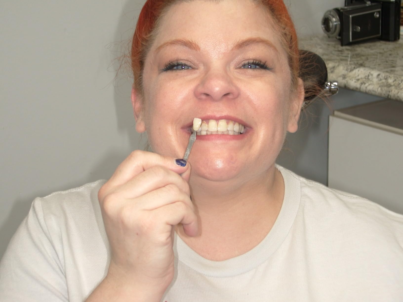 SNOW Diamond Wired Whitening Kit - Sensitive Teeth Whitening Kit - Whitens & Repairs Teeth - 6 Months of Whitening Treatment - Gentle & Enamel Safe - Blue customer photo 2