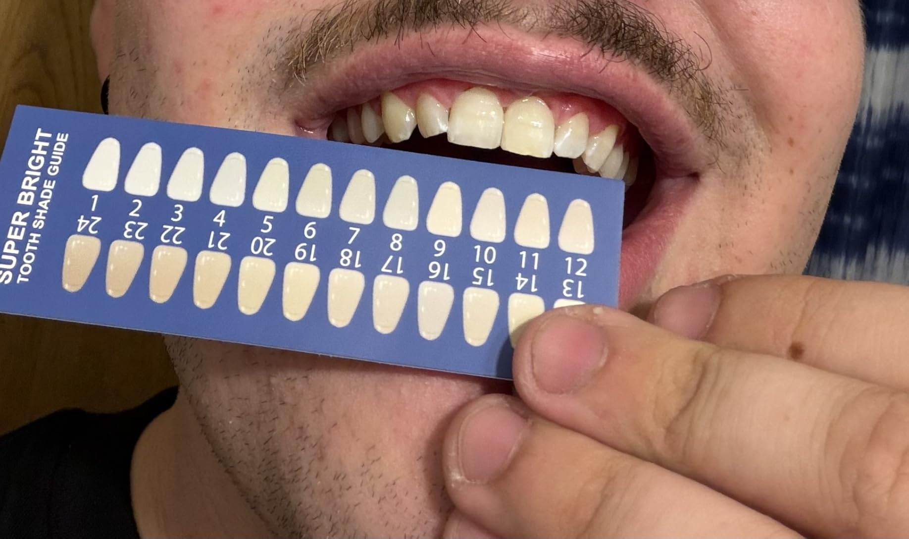 iSmile Teeth Whitening Kit - LED Light, 35% Carbamide Peroxide, (3) 3ml Gel Syringes, (1) Remineralization Gel, and Tray. customer photo 1