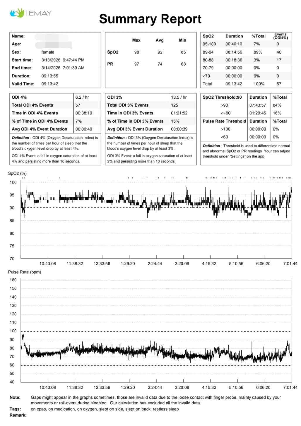 SleepO2 Wrist Recording Pulse Oximeter by EMAY | Continuous Pulse Oximeter to Record Blood Oxygen Saturation and Pulse Rate Overnight customer photo 1