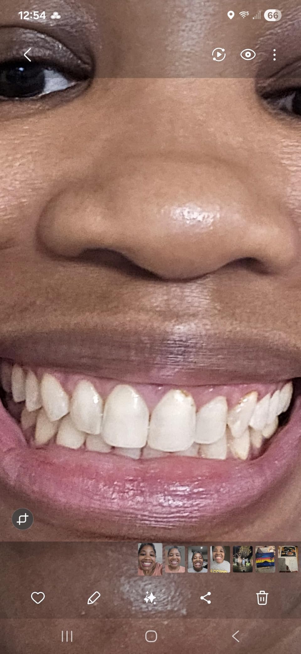 Crest 3D Whitestrips Professional Effects + LED Light - Teeth Whitening Kit, 1 Light + 20 Treatments, Each with 1 Upper/1Lower, 40 Strips - Crest 3DWhite Teeth Whitening Strips customer photo 1
