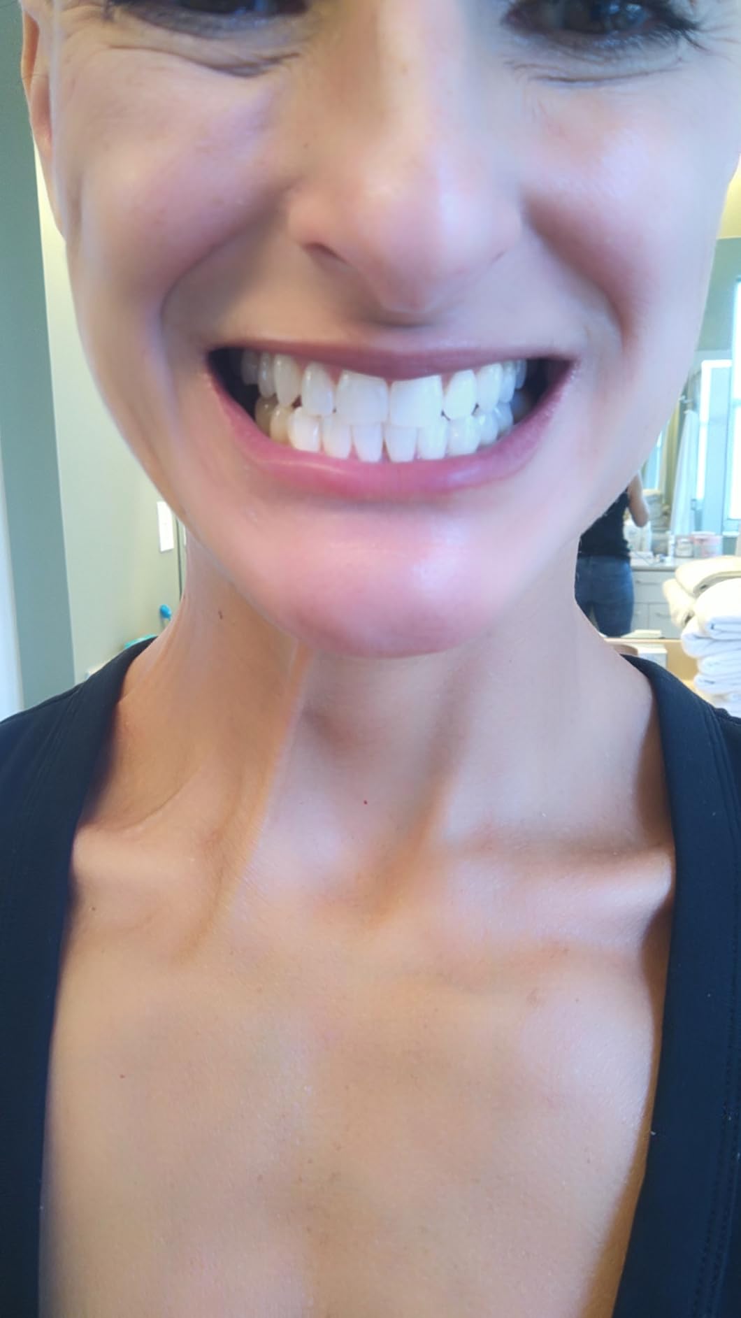 GuruNanda Teeth Whitening Strips - 7-Day Treatment with Non-Slip, Dry Strip Technology - Whitening Designed with Care for a Brighter Smile customer photo 1