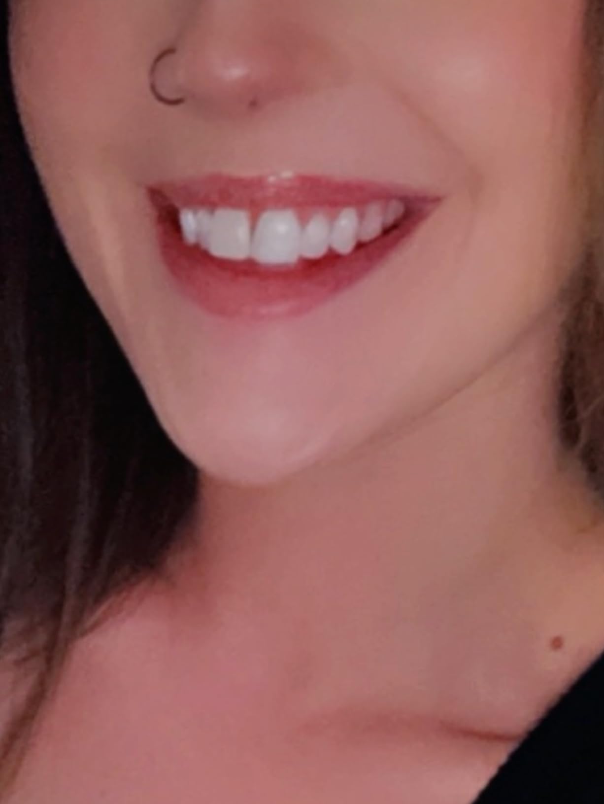 SmileDirectClub Teeth Whitening Kit with LED Light - 4 Pack Gel Pens - Professional Strength Hydrogen Peroxide customer photo 2