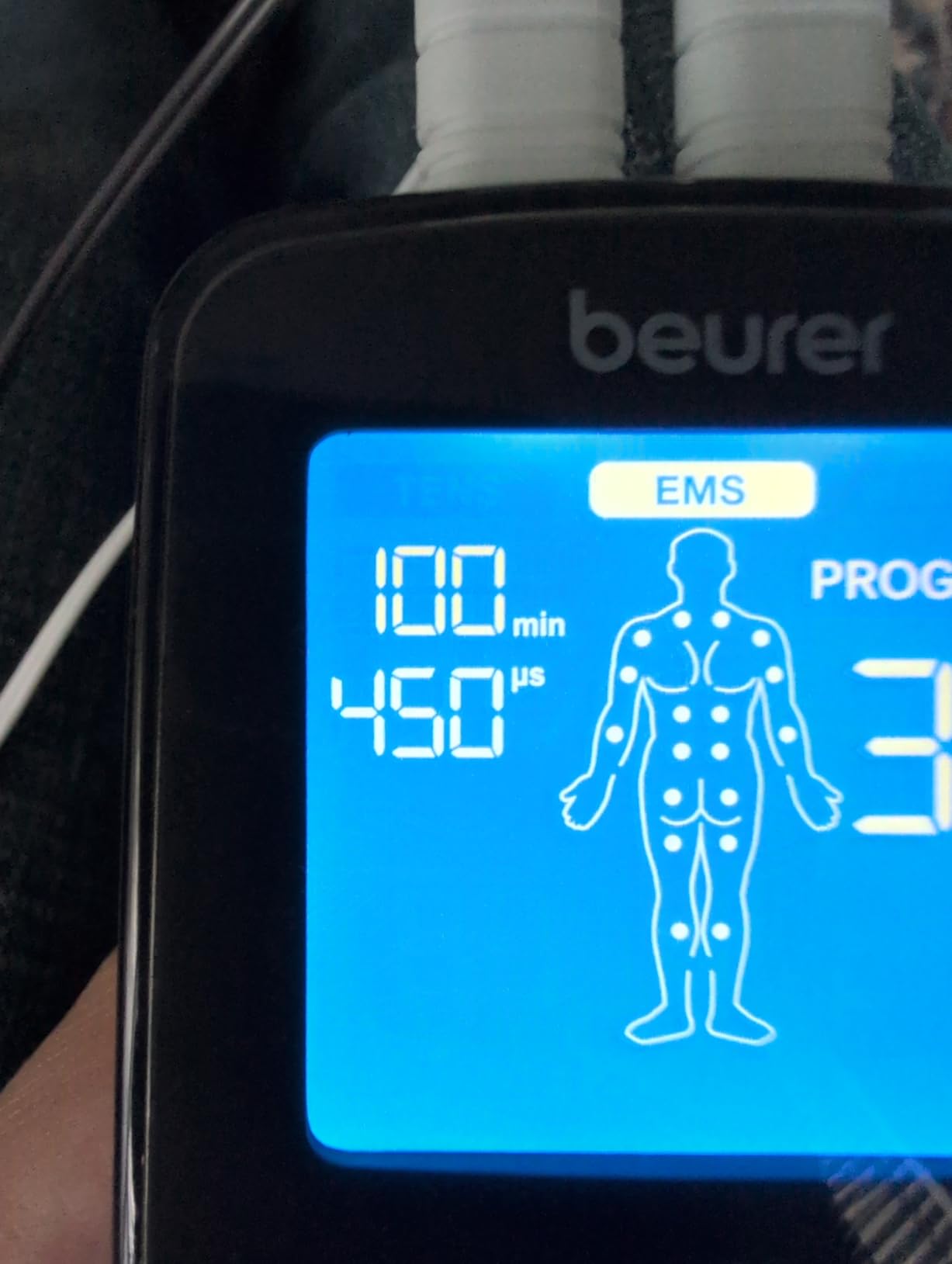 Beurer EM59 Digital 3-in-1 TENS Unit, EMS & Heat Therapy for Pain Relief & Relaxation, Muscle Stimulator with 2 Adjustable Channels customer photo 1