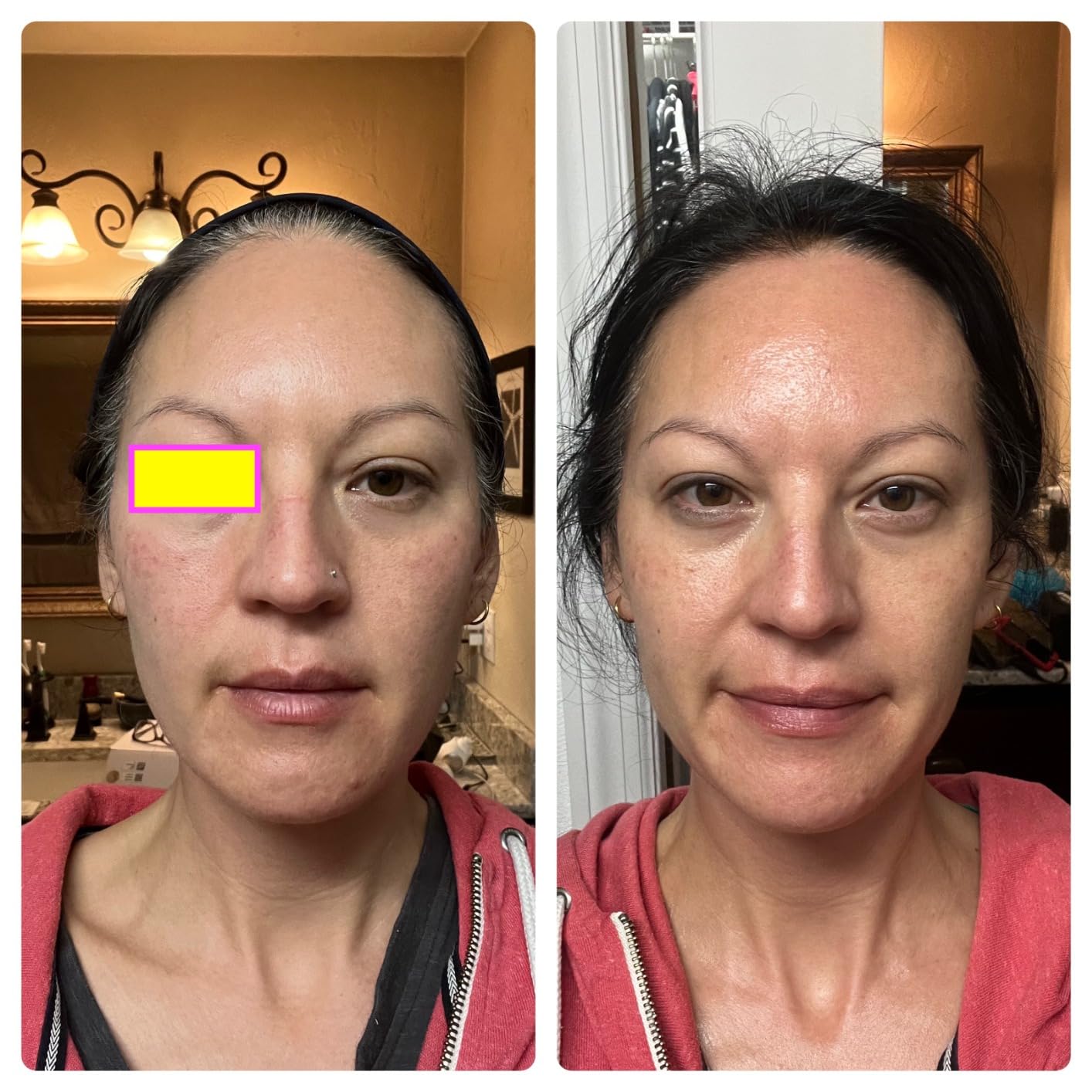 TheraFace Therabody TheraFace PRO - Microcurrent Facial Device, 8-in-1 Compact Face Massager & Facial Sculpting Tool with Light Therapy for Skin Tightening, Anti Wrinkle, Anti Aging & Skin Care (White) customer photo 2