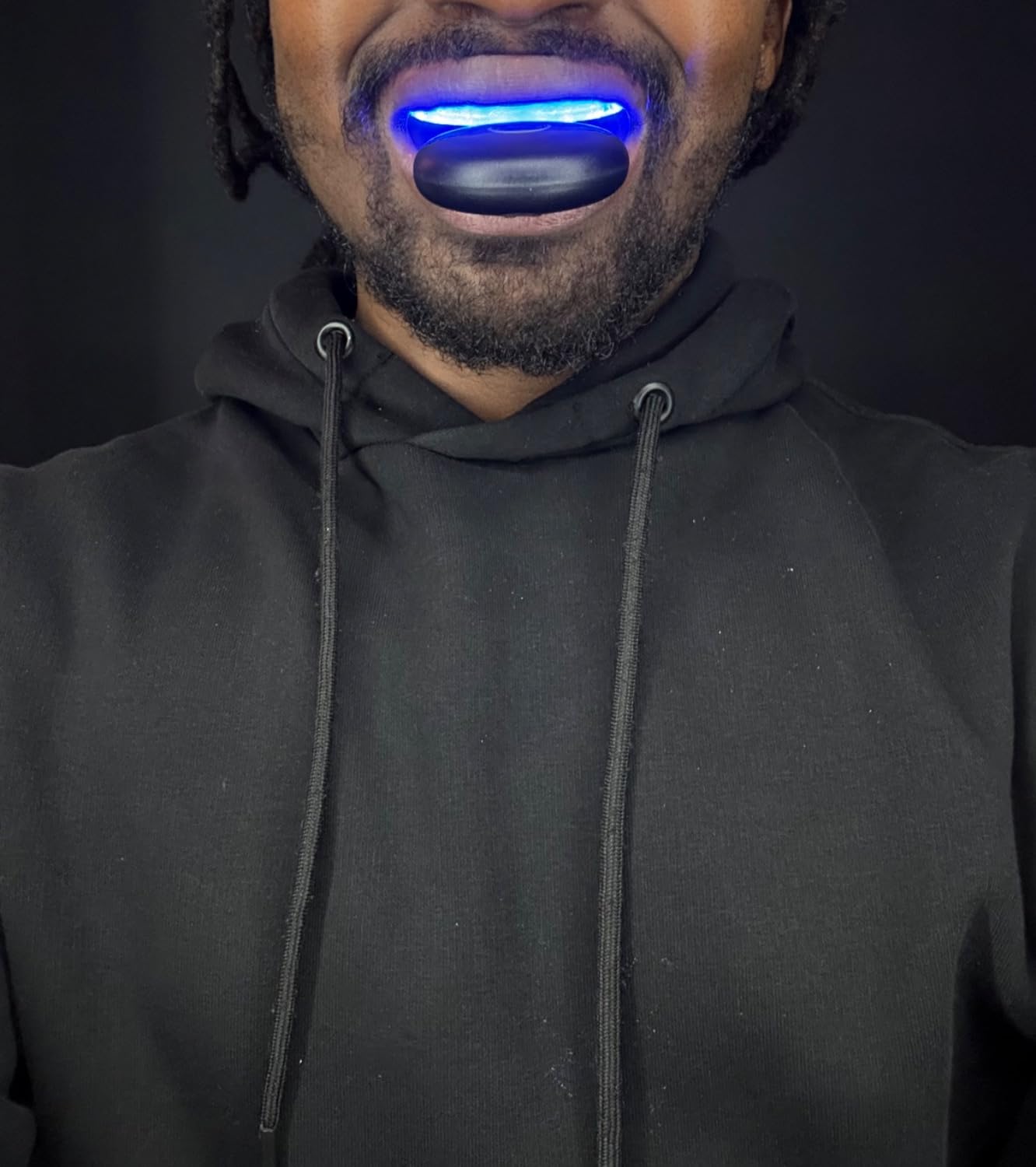 MOON Teeth Whitening Kit, LED Light Teeth Whitener Device, 56 White Strips, USB Charger & Travel Case, Blue Light Whitening Tray Removes Stains & Whitens Up to 12 Shades in 2 Weeks (4 Piece Kit) customer photo 1
