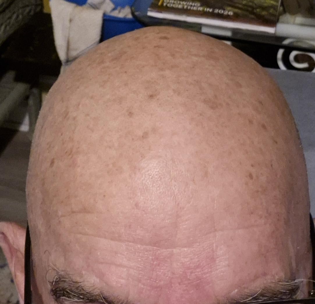 Philips Norelco Shaver 3600 Series, Wet and Dry Electric Shaver, P-Cap, Travel Pouch, Storm Blue, Model S3243/91 customer photo 2