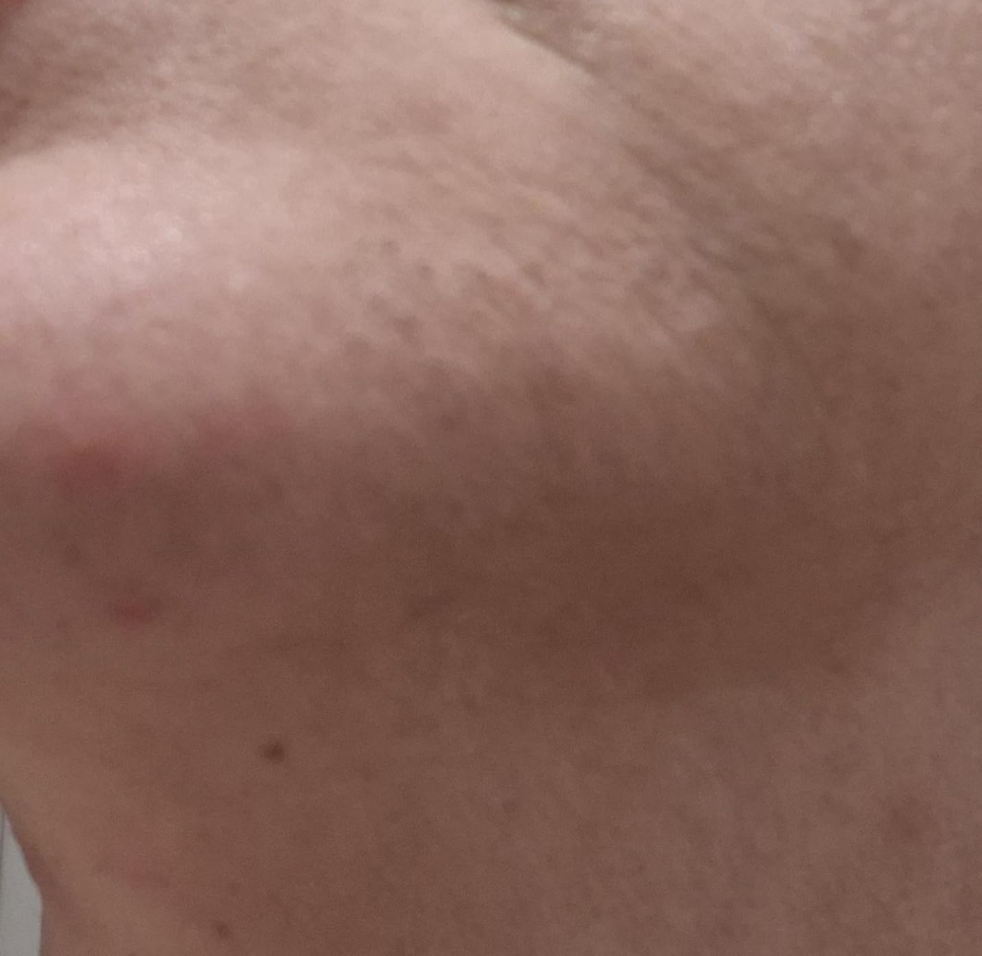 Braun Smart IPL, Skin i·Expert Pro 7, VOGUE's Best Hair Removal Device, IPL Hair Removal for Women and Men, Permanent Laser Hair Reduction At-Home, World's 1st Smart App, 4 Heads, IPL7387 customer photo 2