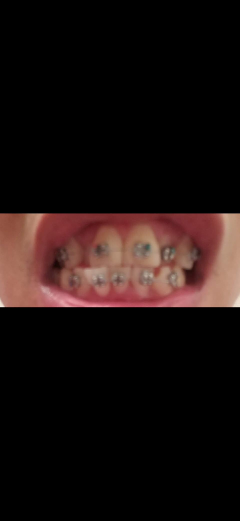 Crest 3D Whitestrips Sensitive & Gentle + LED Light - Teeth Whitening Kit, 1 Light + 14 Treatments, Each with 1 Upper/1Lower, 28 Strips customer photo 1