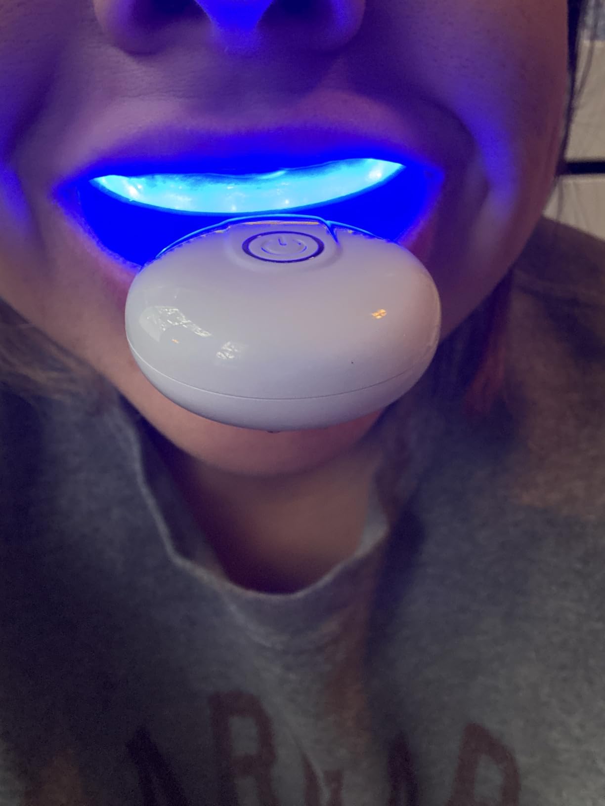 GuruNanda Professional Teeth Whitening Wireless Kit with LED Light & Whitening Pen, Helps Remove Surface Stains from Coffee, Food, Soda, 40 Treatments customer photo 1