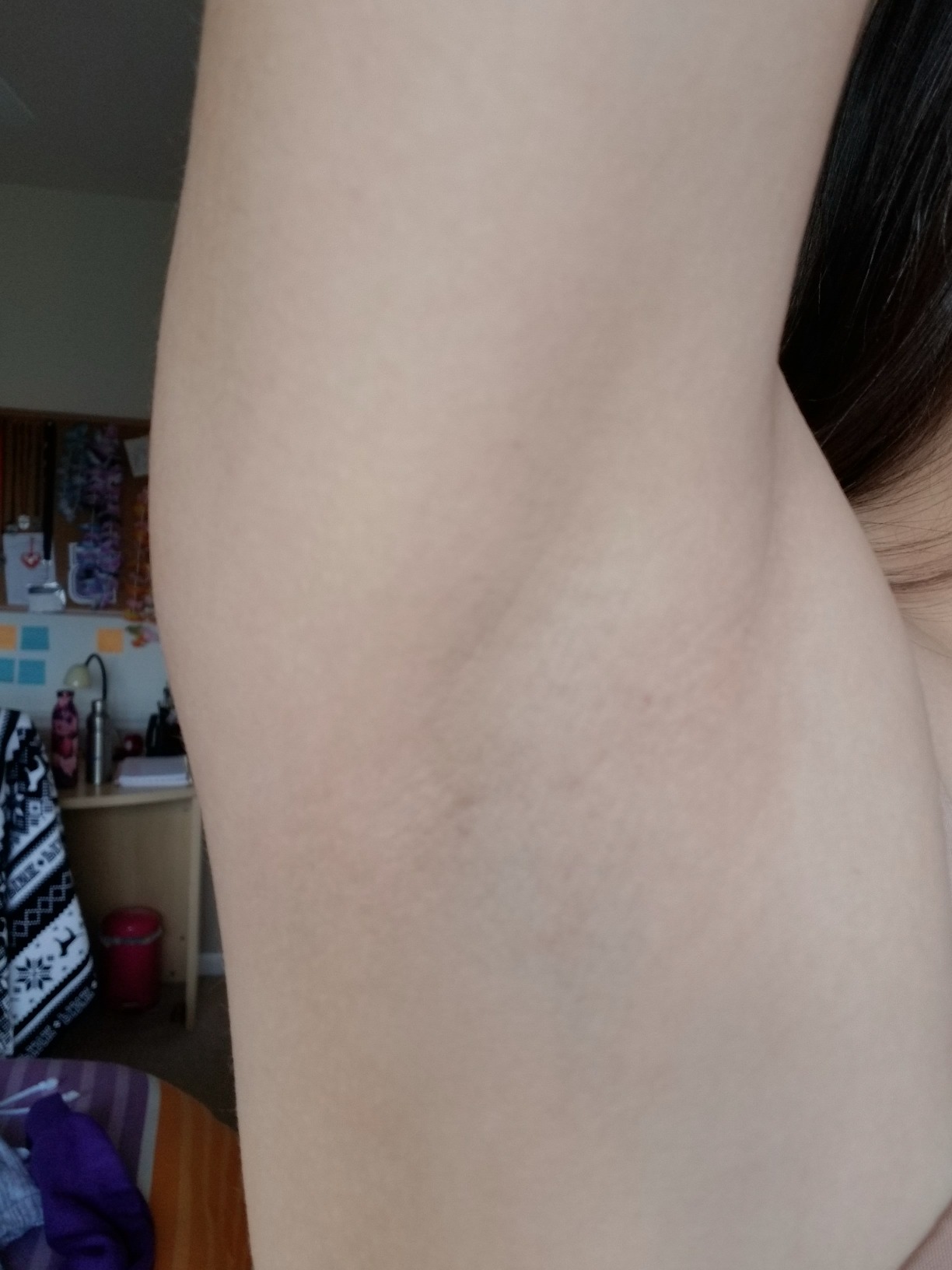Philips Epilator Series 2000, Corded Epilator for Legs and Body, Hair Removal Device for Women, Model BRE227/00 customer photo 1