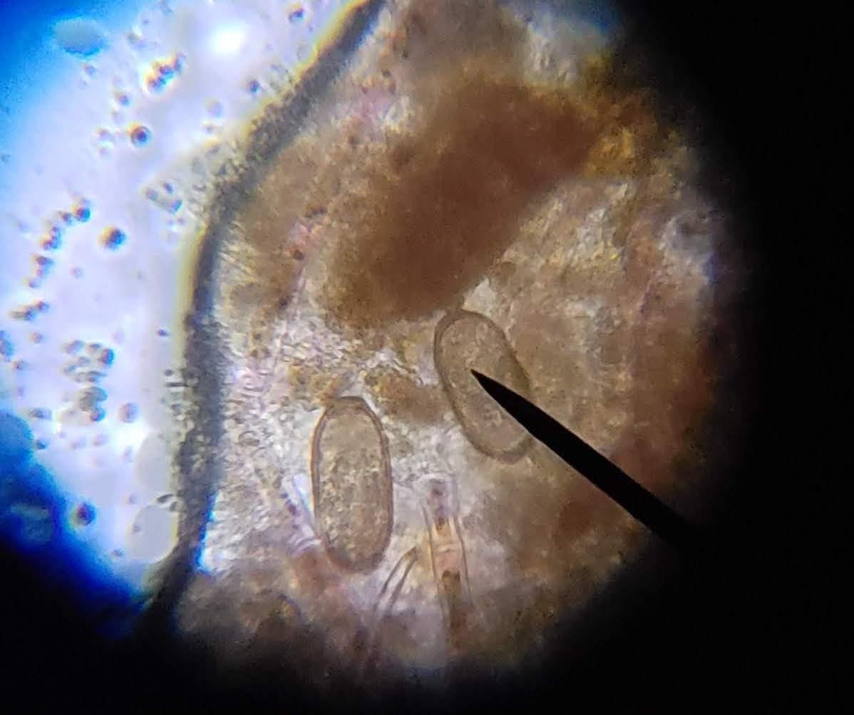AmScope M150C / M150C-I 40X-1000X All-Metal Optical Glass Lenses Cordless LED Student Biological Compound Microscope customer photo 1