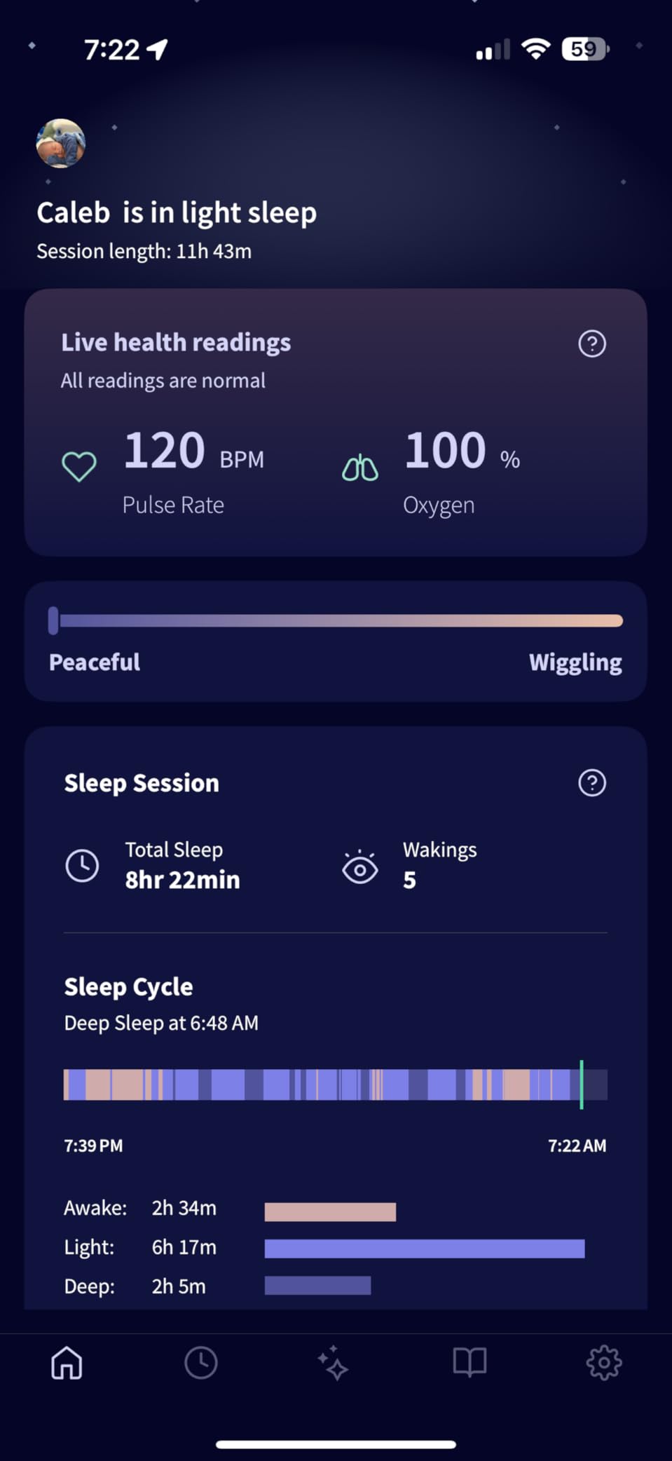 Owlet Dream Sock - Smart Baby Monitor View Heart Rate and Average Oxygen O2 as Sleep Quality Indicators. Wakings, Movement, and Sleep State. Digital Sleep Coach and Sleep Assist Prompts - Mint customer photo 2